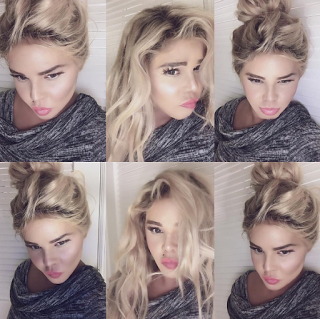 Lil Kim Bleached Skin 2017
