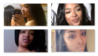 Princess Love Before And After Plastic Surgery
