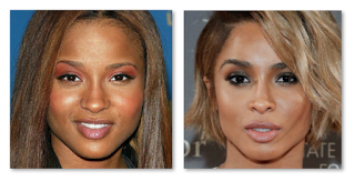 Ciara Before Plastic Surgery