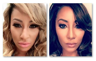 Hazel E Before And After