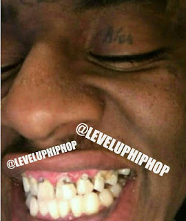 Soulja Boy Teeth – Hacked, LevelUpHipHop Tumblr