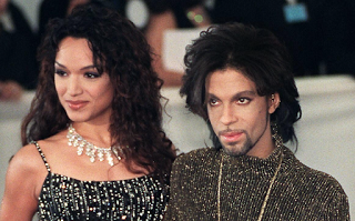 Pfeiffer Syndrome Type 2 – Mayte Garcia