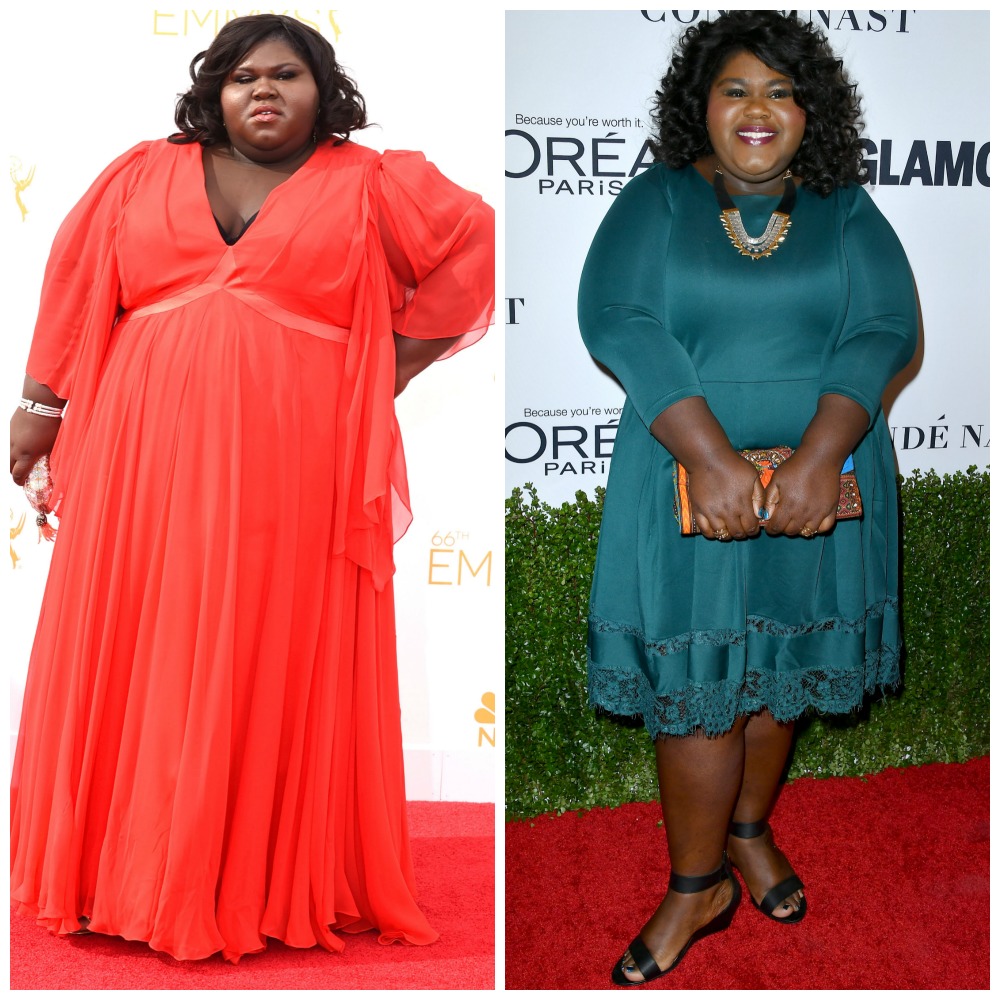 Gabourey Sidibe Weight Loss Surgery