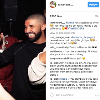 Drake – Nose Job? Did The Vocals Come In?