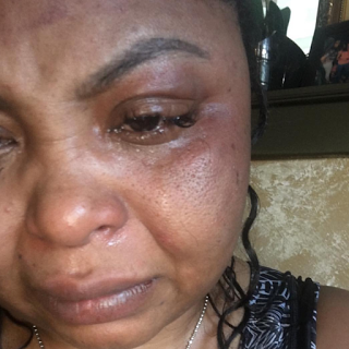 Shekinah Jo Beat Up By Ex-Boyfriend