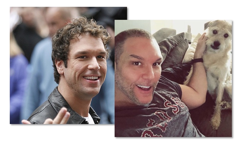 Dane Cook Plastic Surgery